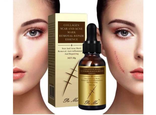 Original%20Scar%20and%20Acne%20Mark%20Removal%20Gel%20Stretch%20Marks/acne/scald/surgical%20Scars%20Treatment%20Cream%20Skin%20Care%20-%20Image%208