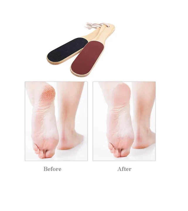 Double%20Sided%20Foot%20File%20Scrubber%20Dead%20Skin%20&%20Callus%20Remover%20Pedicure%20Tool%20with%20Wooden%20Handle%20-%20Image%2010