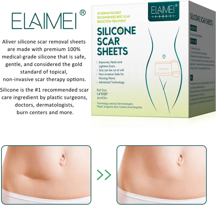 New%20model%201.5M/3M%20Scar%20Removal%20Patch%20Surgery%20Self-Adhesive%20Silicone%20Gel%20Tape%20Remove%20Scar%20Patch%20Sticker%20Acne%20Trauma%20Burn%20Scar%20Skin%20Care%20-%20Image%204