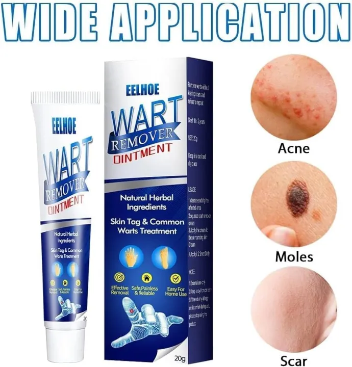 eelhoe%20wart%20removal%20ointment%20-%20Image%203