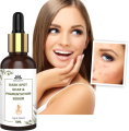 Dark Spot, Scar & Pigmentation Face Serum 10ml. 