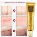 TCM Scar and Acne Marks Removal Gel, Scars, Burns, Stretch Marks, Acne Spots, Treatment Gel Ointment for Face and Body 30g. 