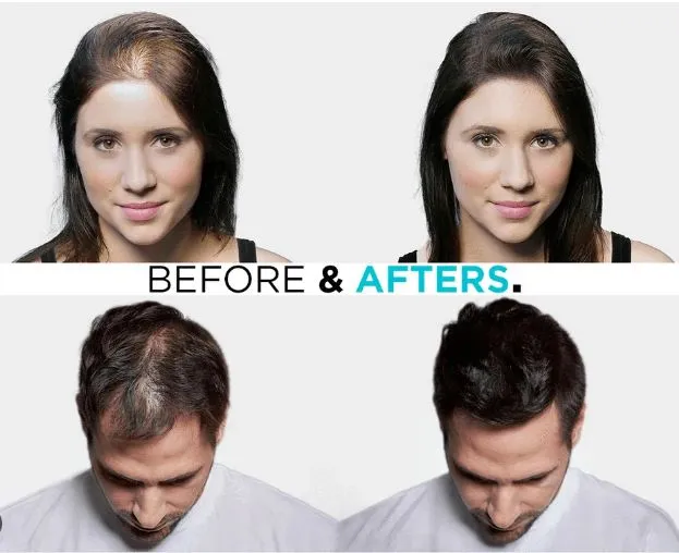 TopPik%20Hair%20Fibers%20with%20Comb%20&%20Applicator%20Effortless%20Application%20for%20Thicker,%20Fuller%20Hair%20-%20Image%203