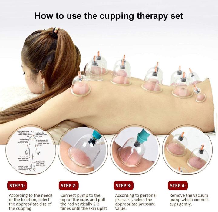 Vacuum%20Cupping%20Therapy%20Set%206%20pcs%20for%20Acupressure%20Massage%20Body%20Pain%20Relief%20Cupping%20-%20Image%202