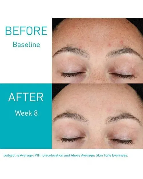 CeraVe%20Resurfacing%20Retinol%20Serum%20-%2030ML%20-%20Image%204