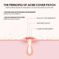 【Too much love!】200pcs Five Star Pimple Patch Acne Colorful Invisible Acne Removal Stickers Face Spot Beauty Makeup Tool Skin Care Products. 