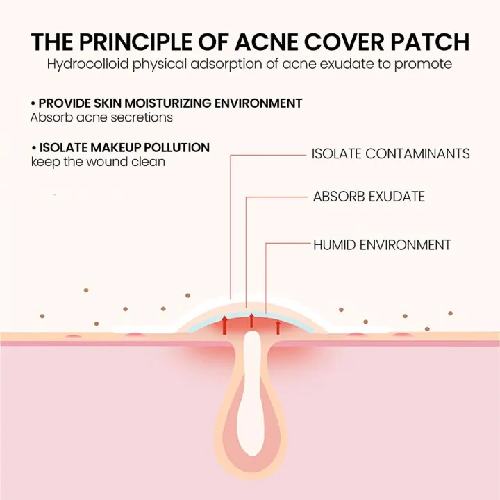%E3%80%90Too%20much%20love!%E3%80%91200pcs%20Five%20Star%20Pimple%20Patch%20Acne%20Colorful%20Invisible%20Acne%20Removal%20Stickers%20Face%20Spot%20Beauty%20Makeup%20Tool%20Skin%20Care%20Products%20-%20Image%208