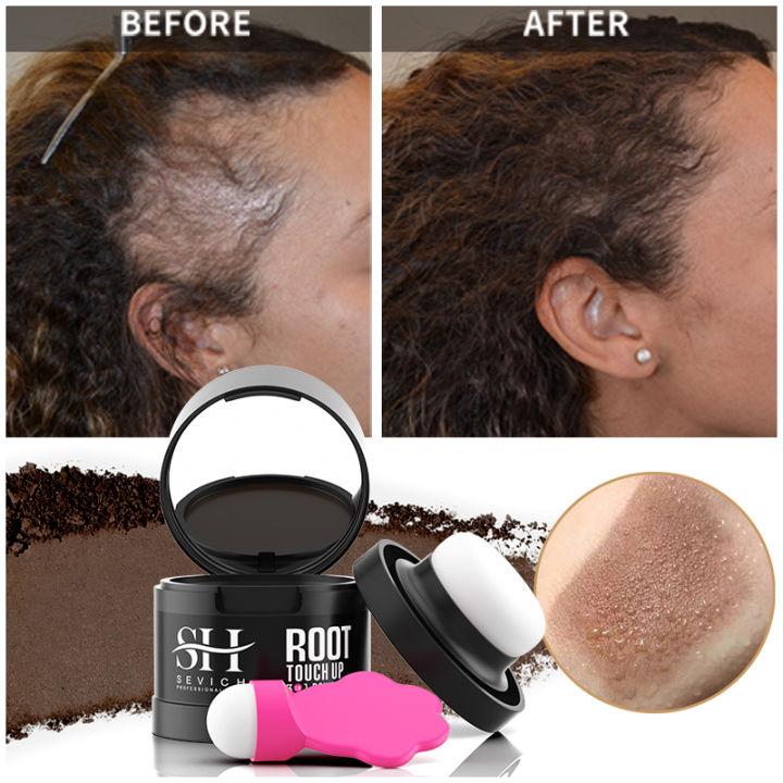 2024 Sevich New Hairline Powder 4g Black Root Cover Up Instant Waterproof 2025新款，Jinnikaiji Hair Line Shadow Powder Hair Concealer Coverage Makeup