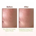 Mamaearth Rice Water Dewy Face Toner with Rice Water & 4% Niacinamide for Glass Skin 150ml. 