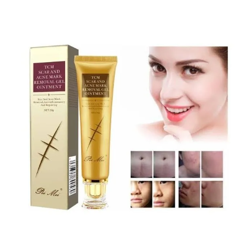 Pei%20Mei%20TCM%20Scar,%20Stretch%20And%20Acne%20Mark%20Removal%20Gel%20Ointment%2030GM%20-%20Image%203