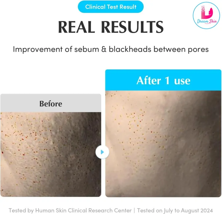 Eqqualberry%20Swimming%20Pool%20Toner%20Pads%20%5B220ml%20%7C%2070%20Pads%5D%20By%20Dream%20Skin%20Nepal%20-%20Image%206