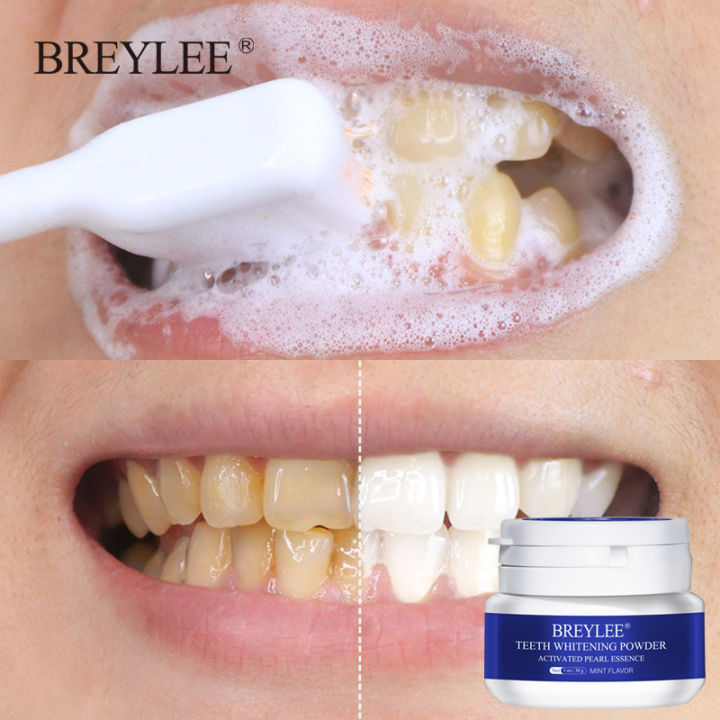 【Good-Love Store】BREYLEE Powder Remove Plaque Stains Bleaching paste Tools Oral ing Hygiene White Teeth Care