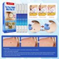 Pack Of 4 Skin Tag Remover Pen Natural Mole Nevus Wart Skin Tag. 