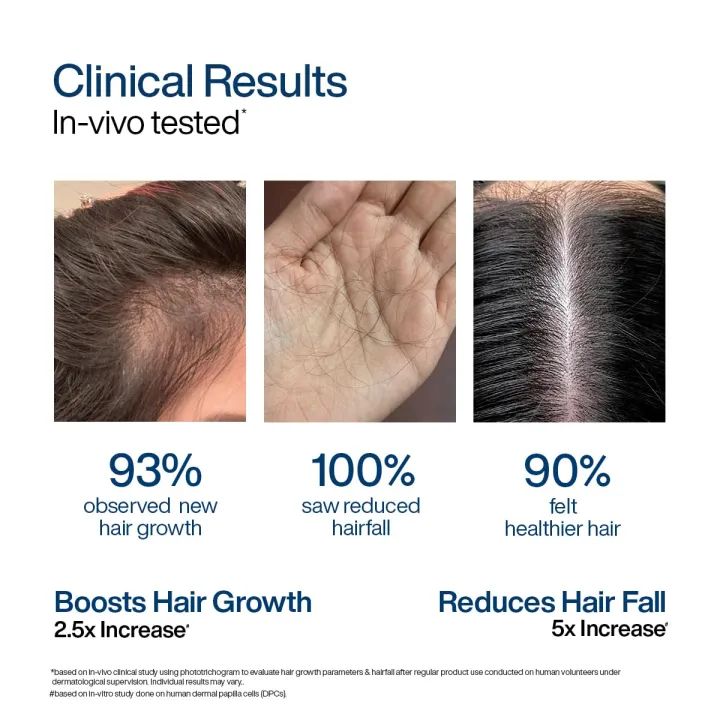 New%20WishCare%20Hair%20Growth%20Serum%20Concentrate%20-%203%25%20Redensyl,%204%25%20Anagain,%202%25%20Baicapil,%20Caffeine,%20Biotin,%20Plant%20Keratin%20&%20Rice%20Water%20-%20Hair%20Growth%20Serum%20for%20Men%20&%20Women%20-%2030ml%20-%20Image%204