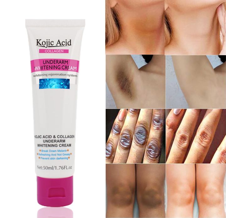 Kojic Acid and Collagen Underarm Cream 50ml - Original Genuine Product with No Side Effects