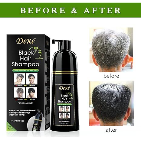 Dexe%20Hair%20Dye%20Shampoo%2013.5%20Fl%20Oz,%20Semi-Permanent%20Black%20Hair%20Dye,%20Hair%20Color%20Shampoo,%20Black%20Hair%20Shampoo%20For%20Men%20&%20Women,%20Mild%20Plant%20Formula%20Black%20Hair%20Dye%20Shampoo,%20100%25%20Gray%20Coverage%20(black)%20-%20Image%202