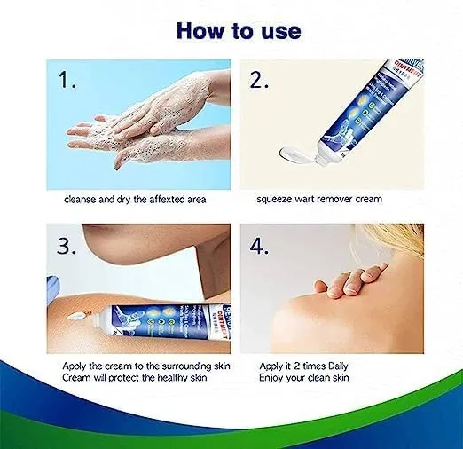 Wart%20Remover%20creaml%20%7C%20Skin%20Tag%20Remover%20cream%20%7C%20massa%20remover%20ointment%20for%20skin%20%7C%20Painless%20Wart%20&%20Skin%20Tag%20Removal%2020g%20-%20Image%204