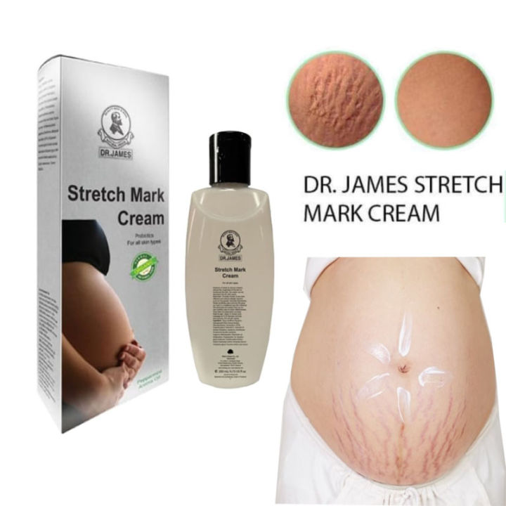 Dr James Stretch Mark Cream 200Ml