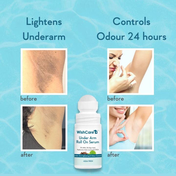 Wishcare%20Aqua%20Fresh%20Under%20Arm%20Roll%20On%20Serum%205%25%20AHA%20&%203%25%20Kojic%20Acid%20-%20Treats%20Pigmentation%20&%20Odour%2050ml%20-%20Image%203