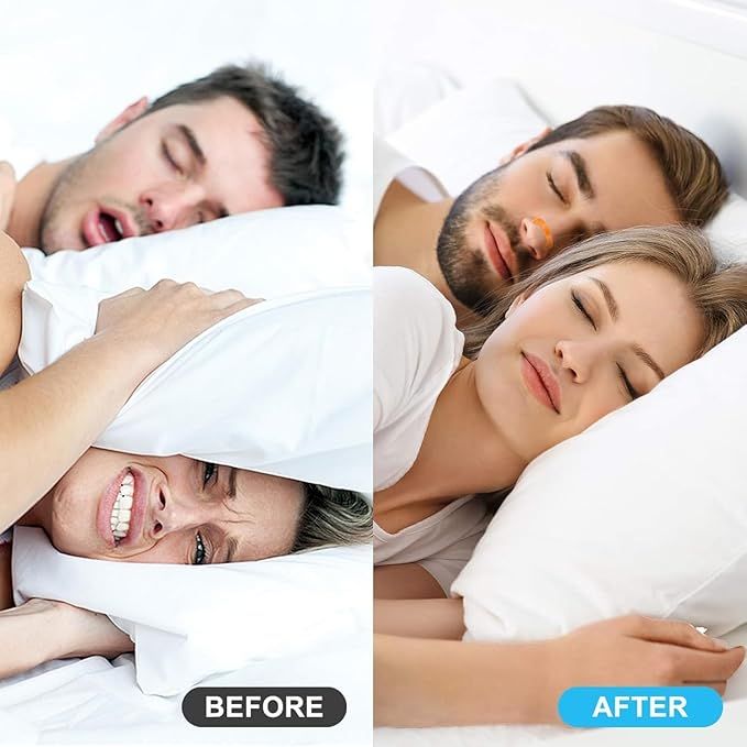 Magnetic%20Nasal%20Strips%20for%20Anti-Snoring%20and%20Better%20Sleep%20%7C%20Skin-Safe%20Nasal%20Pads%20%7C%20Improve%20Breathing%20and%20Sleep%20Quality%20%7C%20Snore%20Stopper%20for%20Home%20and%20Travel,%20and%20Active%20Lifestyles%20%7C%20Skin-Friendly%20and%20Sweat-Resistant%20Design%20%7C%20Ideal%20for%20Men%20and%20Women%20-%20Image%205