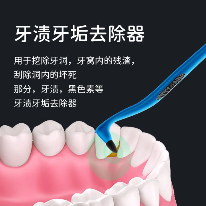 Shunamei%20Portable%20Tooth%20Stain%20Removal%20Tartar%20Cleaning%20Stick%20with%20Handle%20Tartar%20Remover%20Tooth%20Stain%20Cleaner%20-%20Image%204