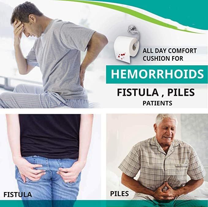 Orthopedic%20Soft%20Foam%20Donut%20Ring%20Cushion%20Pillow%20for%20Piles,%20Hemorrhoids%20Coccyx%20Tailbone%20Fistula%20Sciatica%20Post%20Natal%20Chair%20Lumar%20Pain%20Relief%20During%20Pregnancy,%20Seat%20Pillow,%20Washable,%20Blue%20-%20Image%207