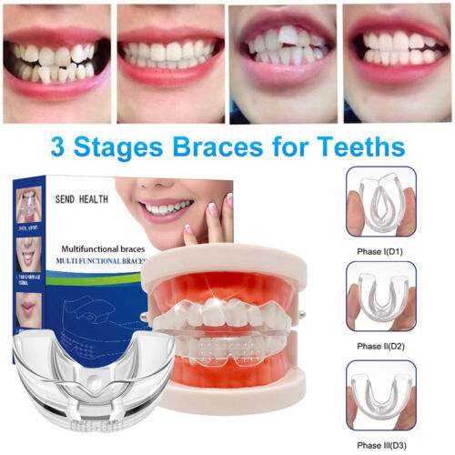 Tooth Protctor Generic Protector Tooth Retainer for Smile Correction 3 Stages Soft and ...