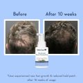 WishCare Hair Growth Serum | Reduces Hair Fall | Boosts Hair Growth | 30 ml. 