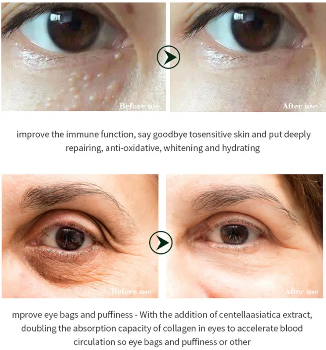 Collagen%20Deep%20Nourishment%20Snail%20Eye%20Cream%20Essence%20Anti-aging%20Eye%20Cream%20Anti-wrinkle%20Dilute%20Dark%20Circles%20Remover%2020ml%20-%20Image%205