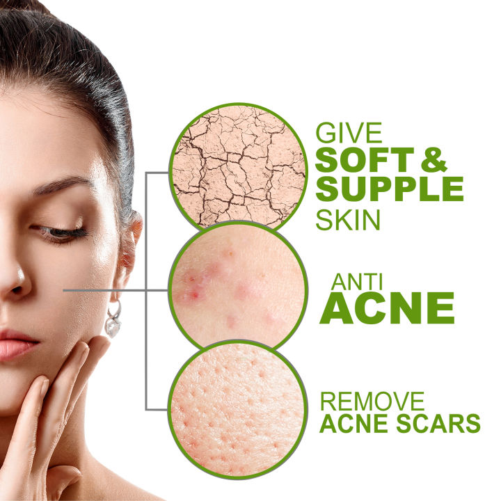 Astaberry%20Neem%20And%20Aloe%20Face%20Wash%2060%20Ml%20Natural%20Herbal%20Skin%20Care%20for%20All%20Skin%20Types%20Deep%20Cleansing%20And%20Pore%20Minimizing%20-%20Image%204