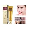 TCM Scar and Acne Marks Removal Gel, Scars, Burns, Stretch Marks, Acne Spots, Treatment Gel Ointment for Face and Body 30g. 