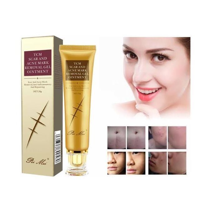 TCM%20Scar%20and%20Acne%20Marks%20Removal%20Gel,%20Scars,%20Burns,%20Stretch%20Marks,%20Acne%20Spots,%20Treatment%20Gel%20Ointment%20for%20Face%20and%20Body%2030g%20-%20Image%207