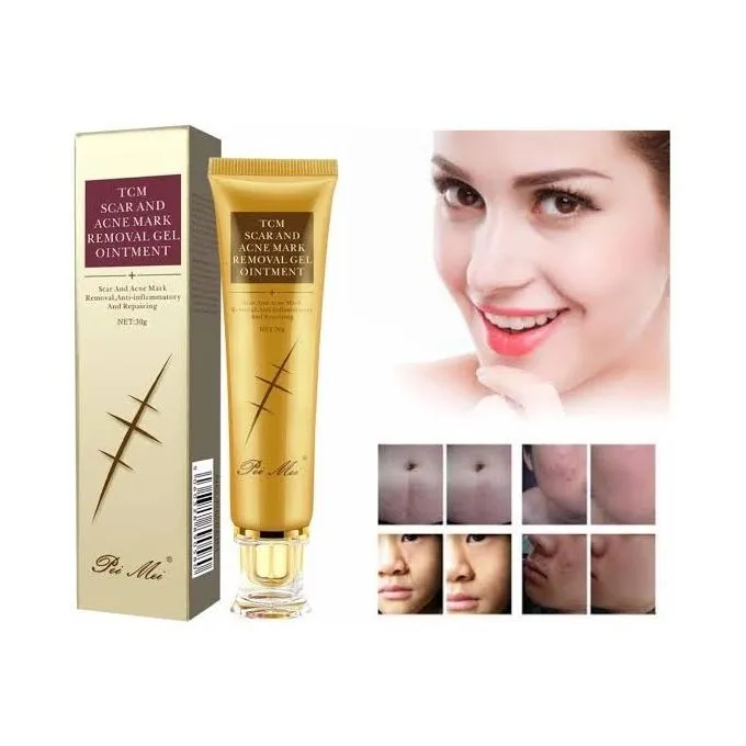 TCM%20Scar%20and%20Acne%20Marks%20Removal%20Gel,%20Scars,%20Burns,%20Stretch%20Marks,%20Acne%20Spots,%20Treatment%20Gel%20Ointment%20for%20Face%20and%20Body%2030g%20-%20Image%207