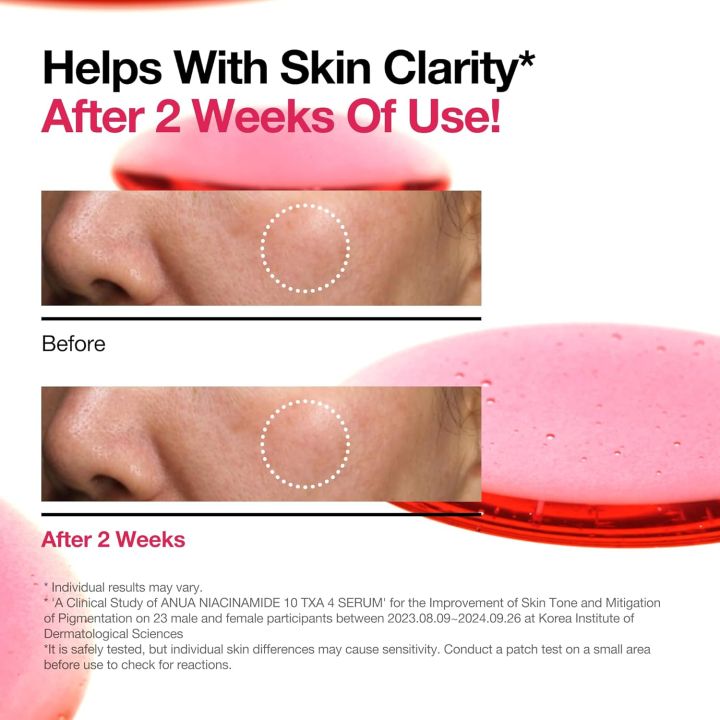 ANUA%20Niacinamide%2010%25%20+%20TXA%204%25%20Brightening%20Serum%20%E2%80%93%20Hyaluronic%20Acid,%20Tranexamic%20Acid,%20Vitamin%20B12%20%E2%80%93%20Korean%20Glass%20Skin%20Formula%20for%20Radiant,%20Clarified%20Complexion%20(30ml%20/%201.01%20fl.oz)%20-%20Image%205