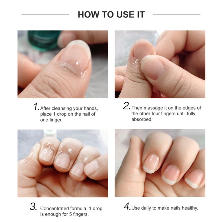 Sales%20promotion%20Nail%20Strengthening%20Cuticle%20Oil,%20Nail%20Growth%20Strengthening%20Serum,%20Strengthening%20Cuticle%20Oil,%20Damaged%20Nail%20Polish,%2015ML%20-%20Image%206