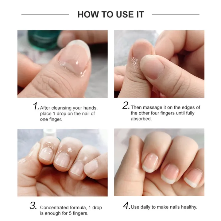 Sales%20promotion%20Nail%20Strengthening%20Cuticle%20Oil,%20Nail%20Growth%20Strengthening%20Serum,%20Strengthening%20Cuticle%20Oil,%20Damaged%20Nail%20Polish,%2015ML%20-%20Image%206