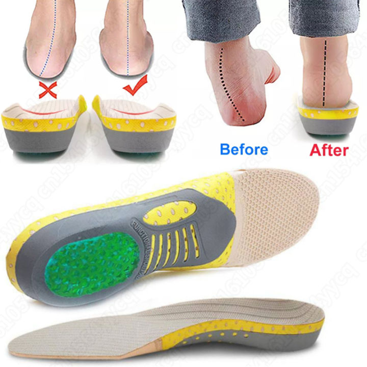 Best%20EVA%20Orthopedic%20Shoes%20Sole%20Insoles%20For%20feet%20Arch%20Foot%20Pad%20X/O%20Type%20Leg%20Correction%20Flat%20Foot%20Arch%20Support%20Sports%20Shoes%20Insert%20-%20Image%203