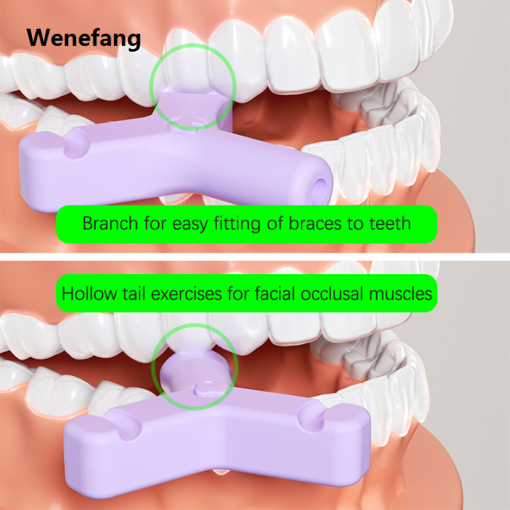 Wenefang%201/4PCS%20Dental%20Aligner%20Chewies%20Silicone%20Teeth%20Stick%20Bite%20Orthodontic%20Luxury%20Bite%20Chewies%20Prevent%20Face%20Distortion%20Y%20Shaped%20-%20Image%203
