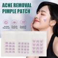 HOT 1Sheet Pimple Acne Concealer Face Spot Scar Care Sticker Patch Acne Removal Cute Tool Pimple Heart Acne Beauty Flower Invis S2H4. 