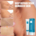 Scar Disappearing Skin Repair Cream. 