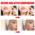 Acne Pimple Master Patch – Transparent Hydrocolloid Spot Treatment for Clear Skin | Korean Beauty Secret (36 Pcs). 