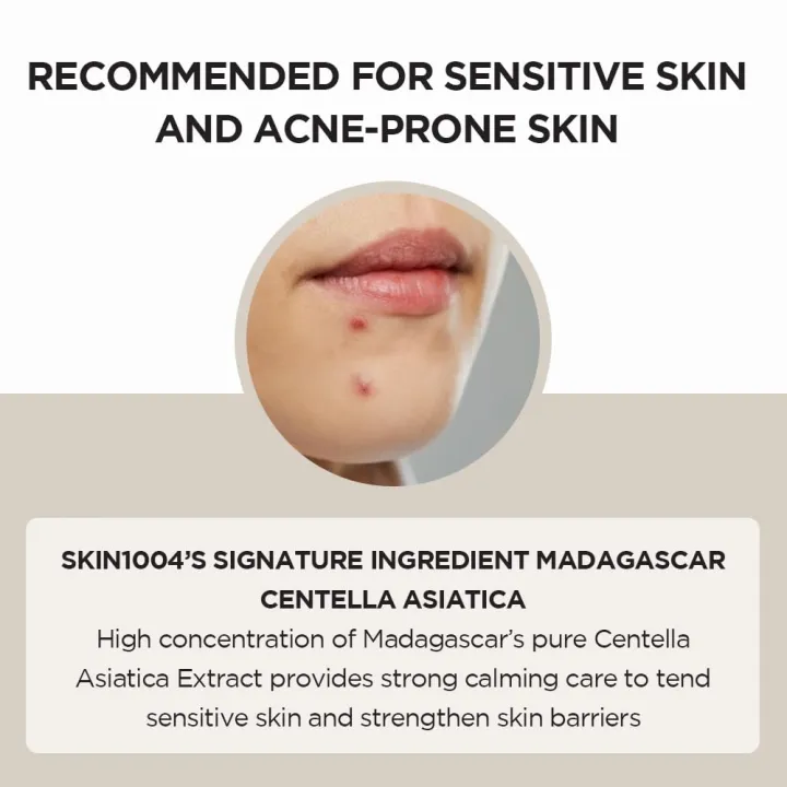 Madagascar%20Centella%20Ampoule%20Facial%20Serum%20%7C%2030ml%20%7C%20For%20Soothing%20Sensitive%20And%20Acne-prone%20Skin%20-%20Image%205