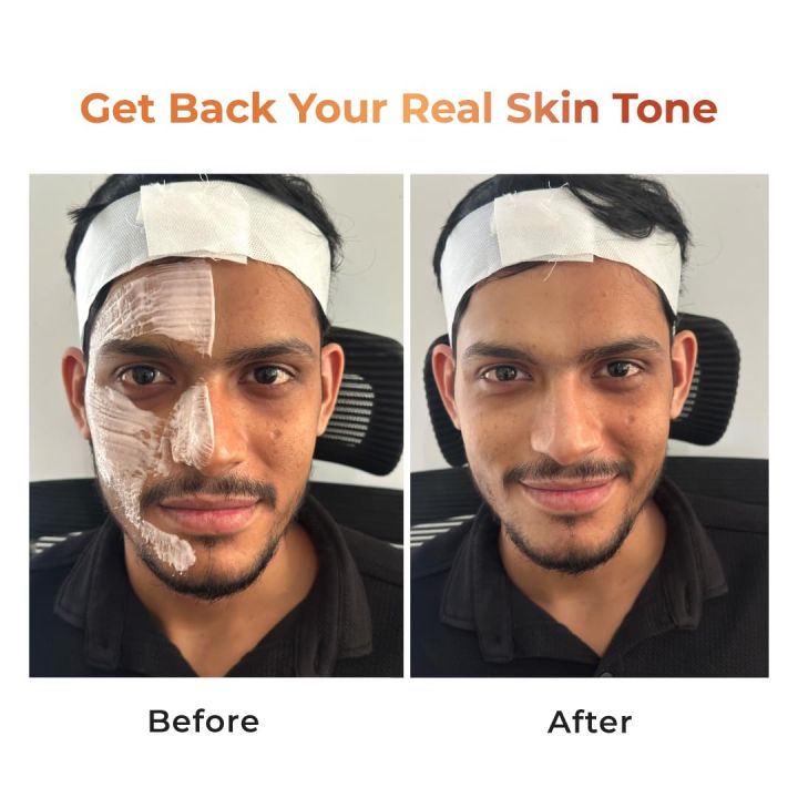 Niconi%20Tan%20Vanish%20Gluta%20Kojic%20Skin%20Polish%20%7C%20Instant%20Tan%20Removal%20&%20Glow%20%7C%20Niconi%20Tan%20Vanish%20%7C%20180g%20-%20Image%208