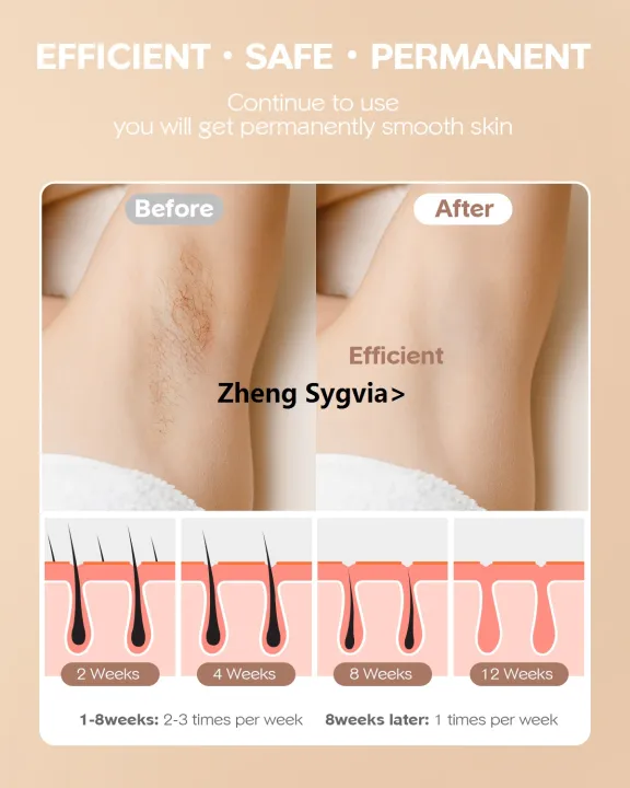 Haodeguiguo%20INNZA%20IPL%20Hair%20Removal%20for%20Women%20at-Home%20999,000%20Flashes%20Painless%20Hair%20Remover%20Device%20for%20Facial%20/Armpits/Legs/Arms/%20Bikini%20Line%20-%20Image%204