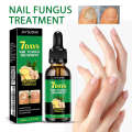 Jaysuing for Treating Gray Nails Nail Care Solution Ginger Essence. 
