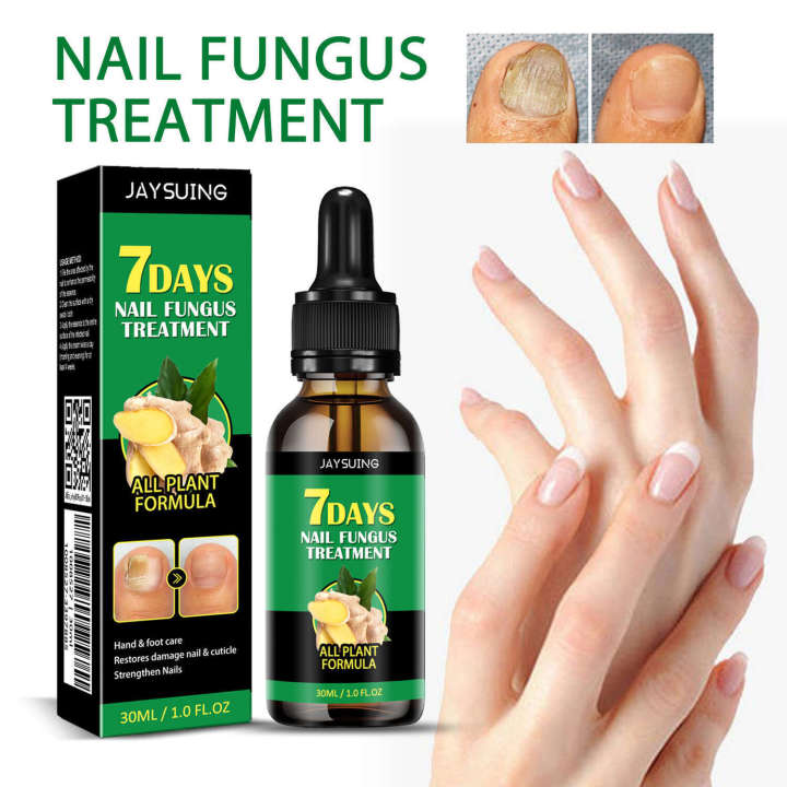 Jaysuing%20for%20Treating%20Gray%20Nails%20Nail%20Care%20Solution%20Ginger%20Essence%20-%20Image%203
