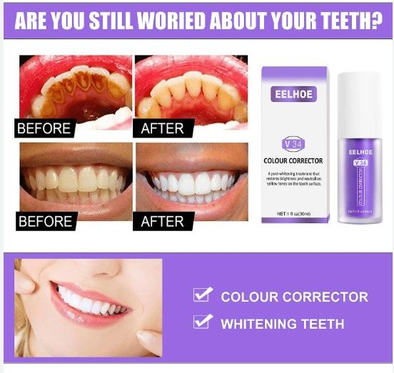 30ml%20Toothpaste%20Teeth%20Whitening%20Remove%20Food%20Particles%20and%20deep%20Stains(V34)%20-%20Image%202