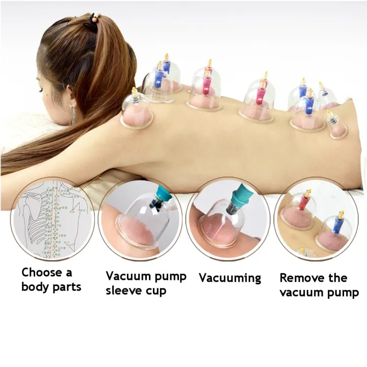 12%20Cups%20Professional%20Acupoint%20Cupping%20Set%20Acupuncture%20Cupping%20Therapy%20Kit%20Cellulite%20Massage%20Kit%20-%20Image%204