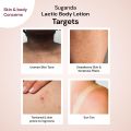 Suganda 2-In-1 Exfoliating & Moisturizing Lactic Acid Body Lotion - 200 Ml. 
