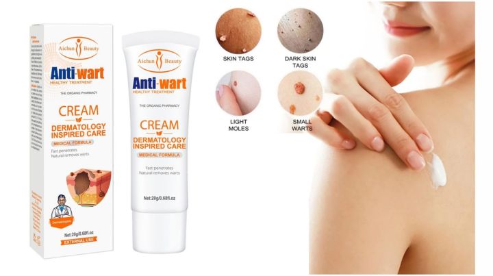 Aichun%20Beauty%20Wart%20Remover%20Cream%20Anti-Wart%20Cream%20Wart%20Treatment%20Skin%20Tags%20&%20Light%20Moles%20Removal%20-20g%20-%20Image%204